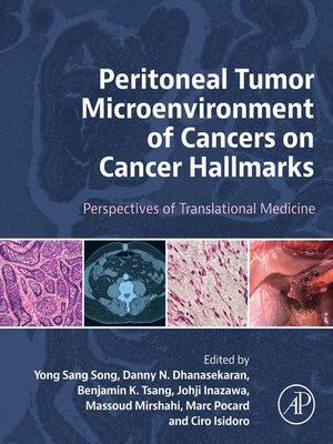 cover image of Peritoneal Tumor Microenvironment of Cancers on Cancer Hallmarks